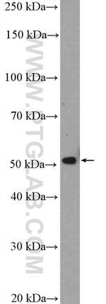 MGAT1 Antibody in Western Blot (WB)