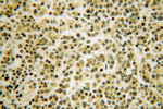 TNIP1 Antibody in Immunohistochemistry (Paraffin) (IHC (P))