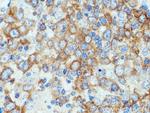 TNIP1 Antibody in Immunohistochemistry (Paraffin) (IHC (P))