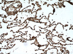 RABEPK/p40 Antibody in Immunohistochemistry (Paraffin) (IHC (P))