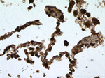 RABEPK/p40 Antibody in Immunohistochemistry (Paraffin) (IHC (P))