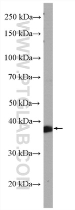 RABEPK/p40 Antibody in Western Blot (WB)