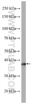 RABEPK/p40 Antibody in Western Blot (WB)