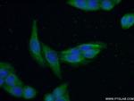 RABEPK/p40 Antibody in Immunocytochemistry (ICC/IF)