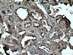 RABEPK/p40 Antibody in Immunohistochemistry (Paraffin) (IHC (P))