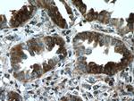 RABEPK/p40 Antibody in Immunohistochemistry (Paraffin) (IHC (P))