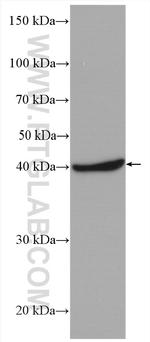 RABEPK/p40 Antibody in Western Blot (WB)