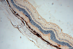AIPL1 Antibody in Immunohistochemistry (Paraffin) (IHC (P))
