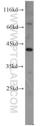 AIPL1 Antibody in Western Blot (WB)