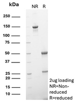 Cathepsin G (Neutrophil Marker) Antibody in SDS-PAGE (SDS-PAGE)
