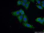 NSDHL Antibody in Immunocytochemistry (ICC/IF)