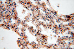 NSDHL Antibody in Immunohistochemistry (Paraffin) (IHC (P))