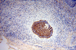 NSDHL Antibody in Immunohistochemistry (Paraffin) (IHC (P))