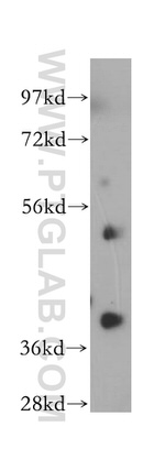 NSDHL Antibody in Western Blot (WB)