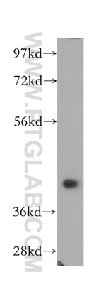 NSDHL Antibody in Western Blot (WB)