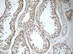 GSK3B Antibody in Immunohistochemistry (Paraffin) (IHC (P))
