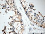 GSK3B Antibody in Immunohistochemistry (Paraffin) (IHC (P))