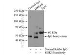 GSK3B Antibody in Immunoprecipitation (IP)