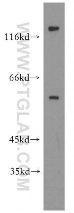 GSK3B Antibody in Western Blot (WB)
