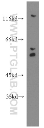 GSK3B Antibody in Western Blot (WB)