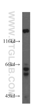 GSK3B Antibody in Western Blot (WB)