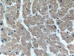 FKBP1B Antibody in Immunohistochemistry (Paraffin) (IHC (P))