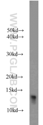 FKBP1B Antibody in Western Blot (WB)