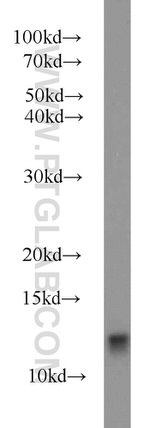 FKBP1B Antibody in Western Blot (WB)