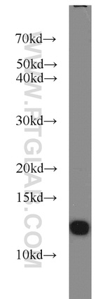 FKBP1B Antibody in Western Blot (WB)