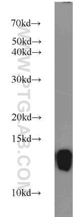 FKBP1B Antibody in Western Blot (WB)