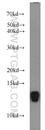 FKBP1B Antibody in Western Blot (WB)