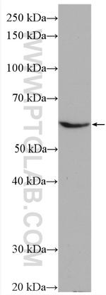 HYAL2 Antibody in Western Blot (WB)