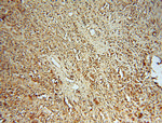 HSD17B4 Antibody in Immunohistochemistry (Paraffin) (IHC (P))