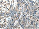 HSD17B4 Antibody in Immunohistochemistry (Paraffin) (IHC (P))