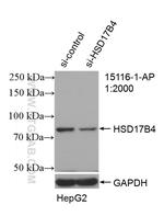 HSD17B4 Antibody in Western Blot (WB)