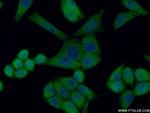 HCCS Antibody in Immunocytochemistry (ICC/IF)