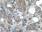 HCCS Antibody in Immunohistochemistry (Paraffin) (IHC (P))