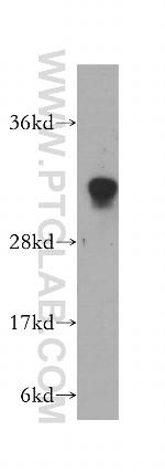 HCCS Antibody in Western Blot (WB)