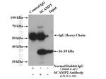 SCAMP2 Antibody in Immunoprecipitation (IP)