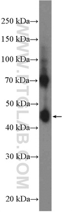 METTL9 Antibody in Western Blot (WB)