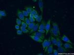 SIRT5 Antibody in Immunocytochemistry (ICC/IF)
