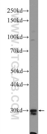 SIRT5 Antibody in Western Blot (WB)