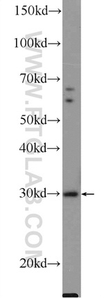 SIRT5 Antibody in Western Blot (WB)