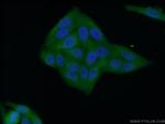NNMT Antibody in Immunocytochemistry (ICC/IF)