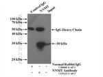 NNMT Antibody in Immunoprecipitation (IP)