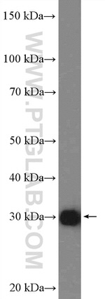 NNMT Antibody in Western Blot (WB)