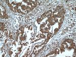 GSTO1 Antibody in Immunohistochemistry (Paraffin) (IHC (P))