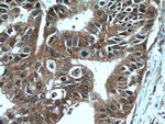 GSTO1 Antibody in Immunohistochemistry (Paraffin) (IHC (P))