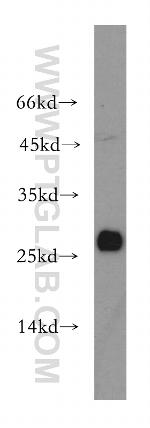 GSTO1 Antibody in Western Blot (WB)