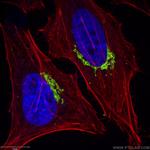GP73/GOLPH2 Antibody in Immunocytochemistry (ICC/IF)